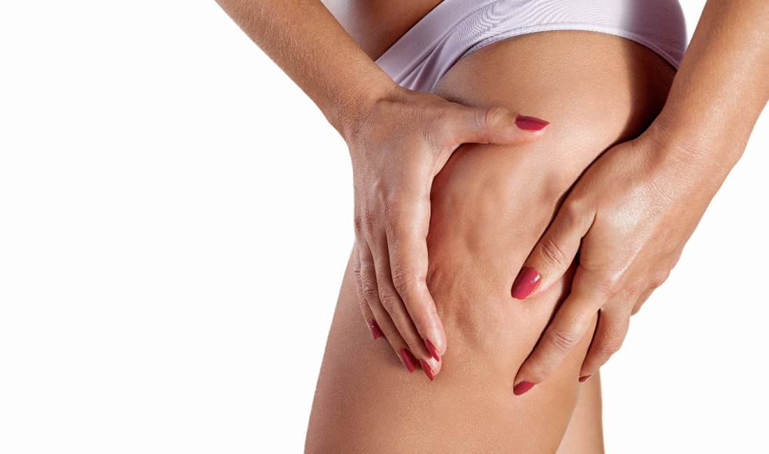 Dita femminili premono la pelle di una coscia evidenziando la cellulite